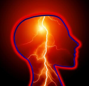 Epilepsy